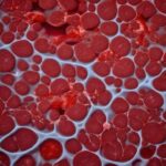 Brain scan showing potential damage from artificial sweetener consumption.